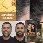 Șampon de Vopsire Păr Negru – Acoperă Firele Albe Rapid, Fără Amoniac, cu Ghimbir, Sevich, 500ml - imagine 4