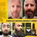 Kit crestere barba – derma roller, Biotin, Rozmarin, stimulare si nutritie naturala, Sevich - imagine 2