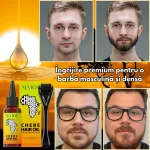 Set crestere barba – derma roller si Ulei Chebe, Biotina, barba deasa si sanatoasa, Sevich - imagine 4