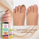 Tratament Intensiv pentru Repararea Unghiilor, Hidratare și Fortifiere, Verilaria, 10ml - imagine 7
